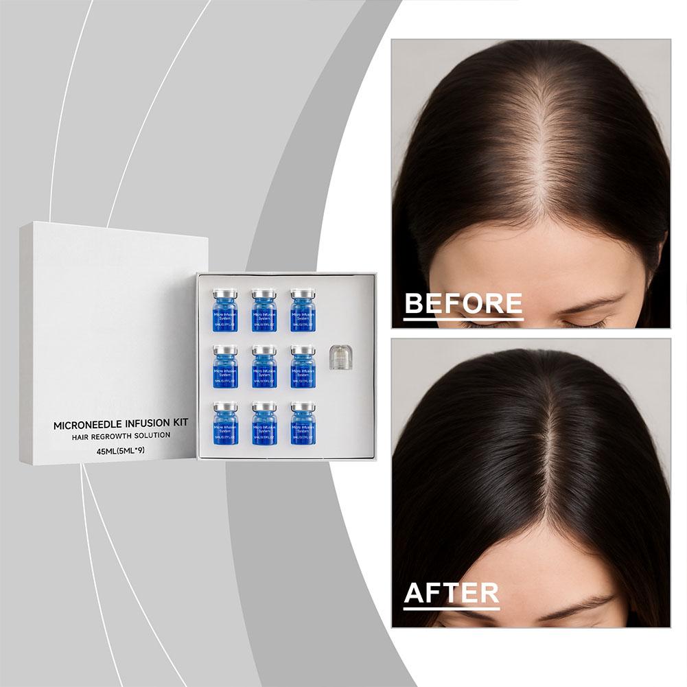 Derma Roller 0.25 - Kit de Rolo de Microagulhas com