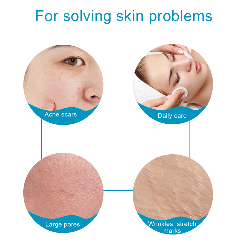1 unidade de Derma Roller de T - Derma Roller 0.25 avaliação e preço